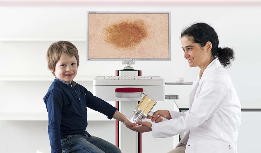 Videodermatoscopía Digital Fotofinder